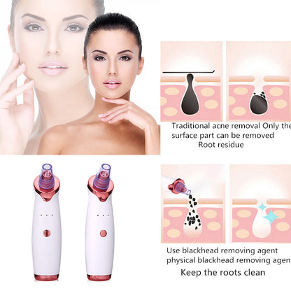 Blackhead Remover Black Dot Remover Acne Vacuum Suction Face Clean Black Head Pore Cleaning Beauty Skin Care Tool